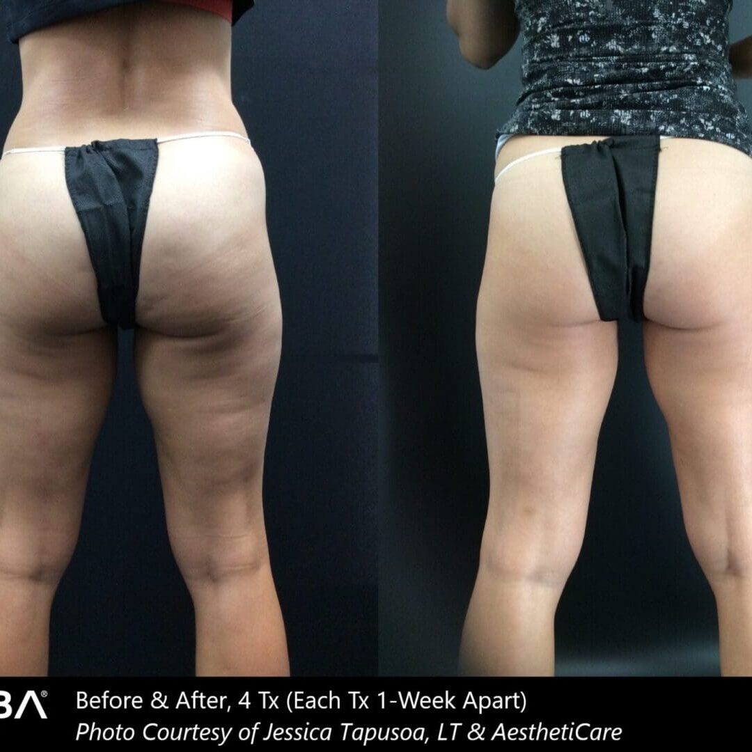 IDC _Before & After Images_1