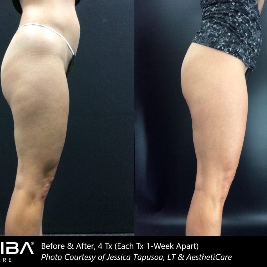 IDC _Before & After Images_2