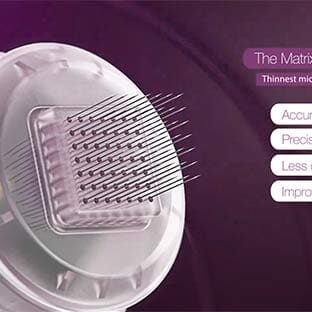 matrixpro-moa-video (1)